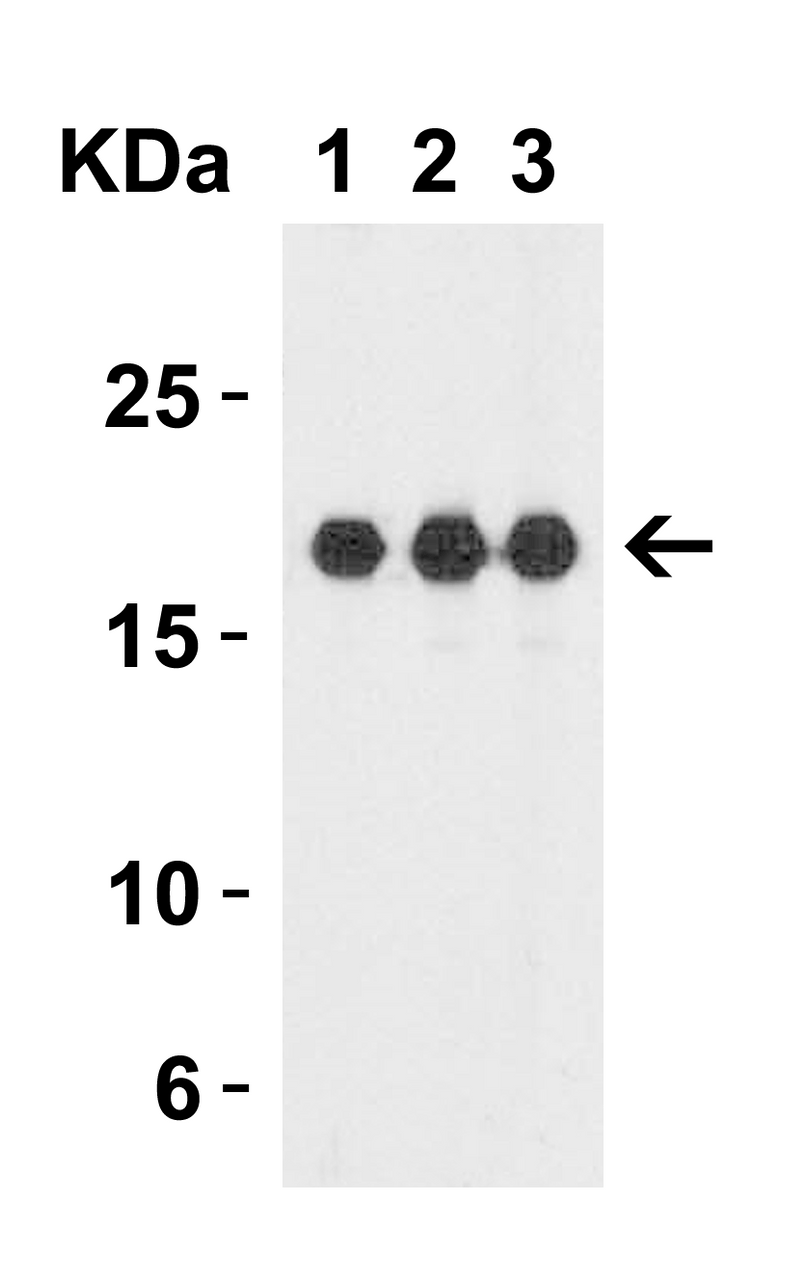 Figure 1 Western Blot Validation with Recombinant Protein
Loading: 30 ng of human IL-1F10 recombinant protein per lane.
Antibodies: IL-1F10 7503 (Lane 1: 1 &#956;g/mL, Lane 2: 2 &#956;g/mL and Lane 3: 4 &#956;g/mL) , 1h incubation at RT in 5% NFDM/TBST.
Secondary: Goat anti-rabbit IgG HRP conjugate at 1:10000 dilution.