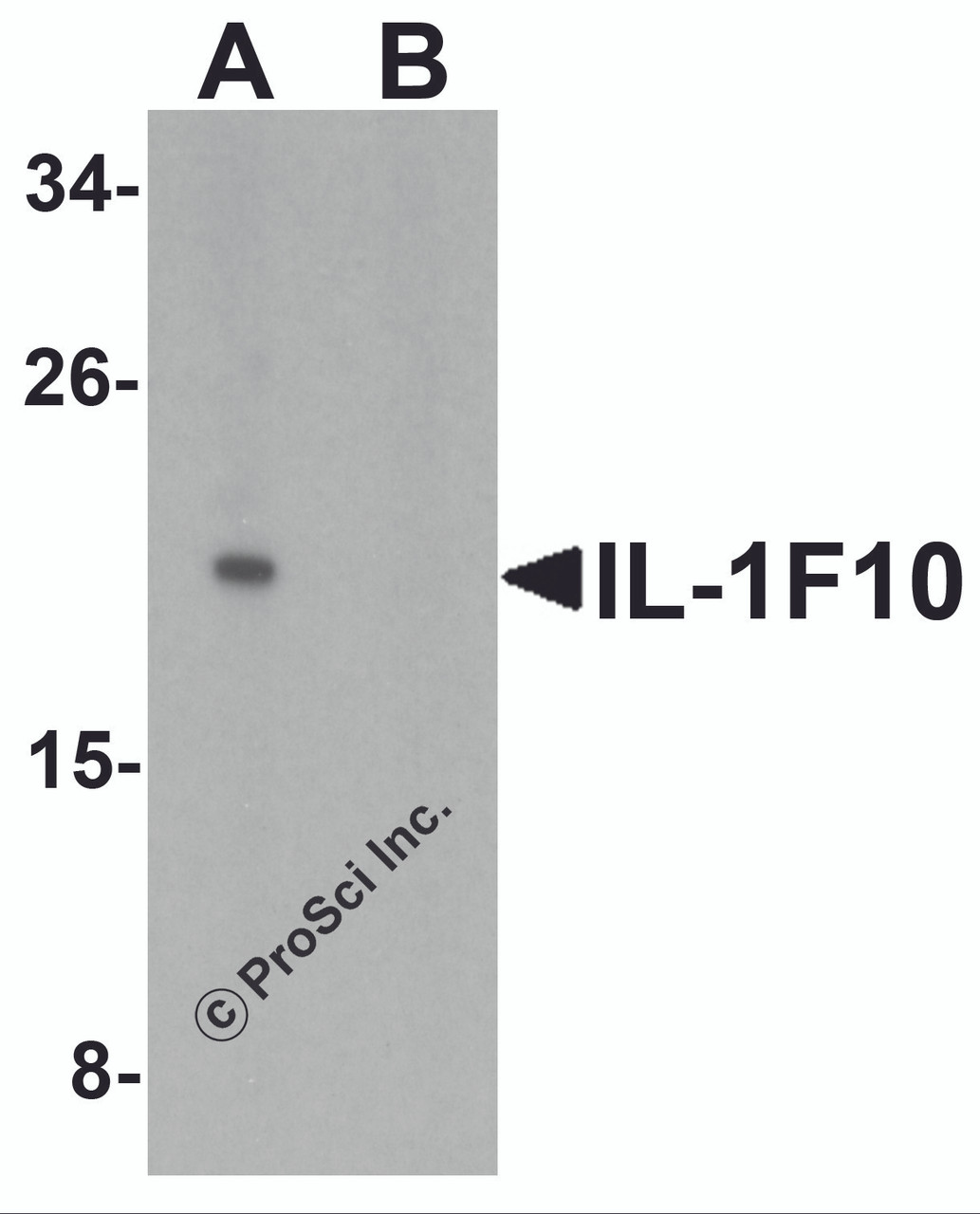Figure 2 Western Blot Validation in Human Liver Tissue Lysate in the (A) absence or (B) presence of blocking peptide
Loading: 15 ug of lysates per lane.
Antibodies: IL-1F10, 7503 (1 ug/mL) , 1h incubation at RT in 5% NFDM/TBST.
Secondary: Goat anti-rabbit IgG HRP conjugate at 1:10000 dilution.