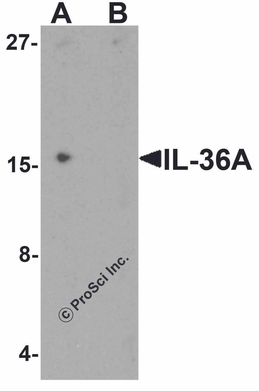 Western blot analysis of IL-36A in MCF7 cell lysate with IL-36A antibody at 1 &#956;g/ml in (A) the absence and (B) the presence of blocking peptide.