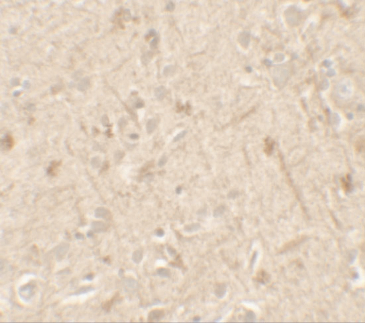 Immunohistochemistry of IL-36A in human brain tissue with IL-36A antibody at 5 ug/mL.