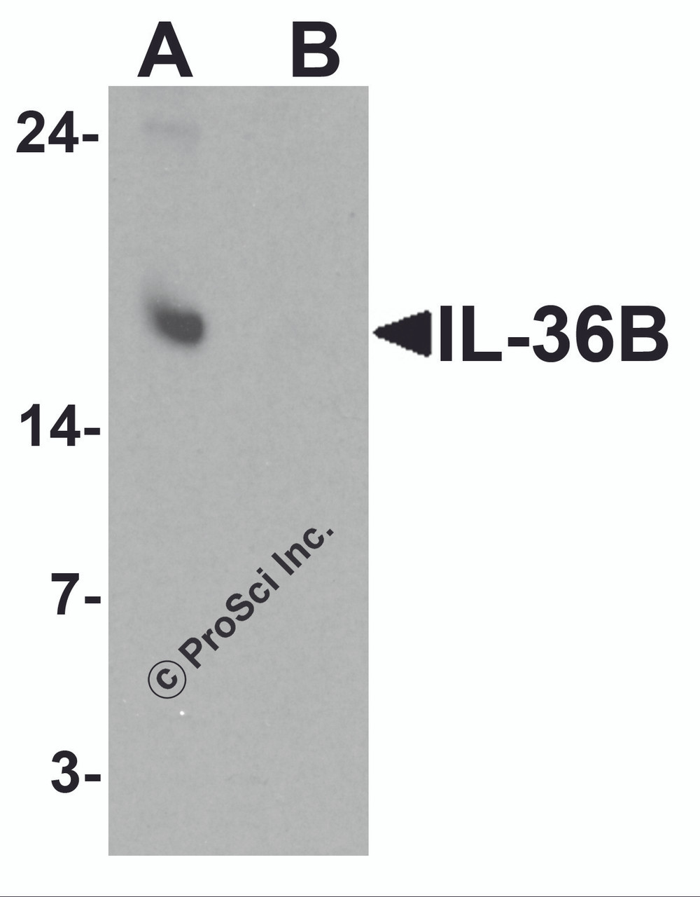 Western blot analysis of IL-36B in A549 cell lysate with IL-36B antibody at 1 &#956;g/ml in (A) the absence and (B) the presence of blocking peptide.