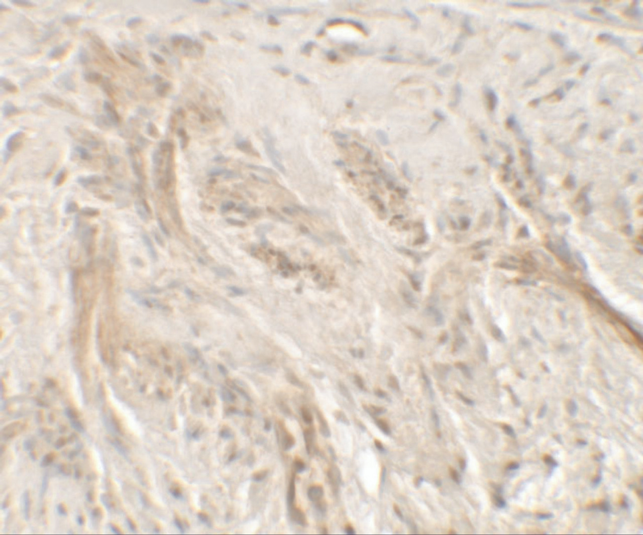 Immunohistochemistry of IL-36G in human bladder tissue with IL-36G antibody at 5 ug/mL.