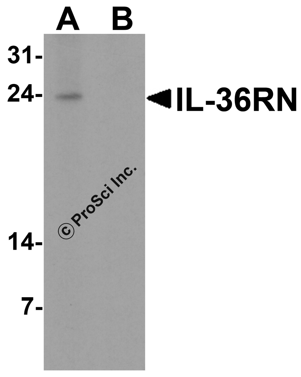 Western blot analysis of IL-36RN in human spleen tissue lysate with IL-36RN antibody at 1 &#956;g/ml in (A) the absence and (B) the presence of blocking peptide.