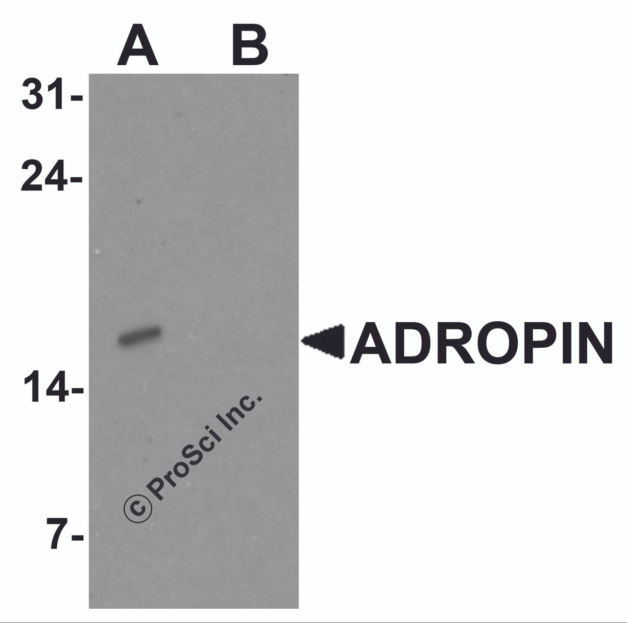 Western blot analysis of ADROPIN in human brain tissue lysate with ADROPIN antibody at 2 &#956;g/ml in (A) the absence and (B) the presence of blocking peptide.