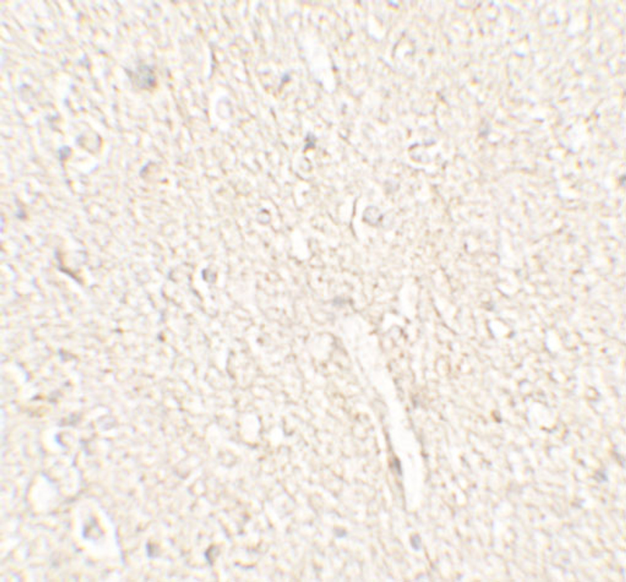 Immunohistochemistry of ADROPIN in human brain tissue with ADROPIN antibody at 5 ug/mL.