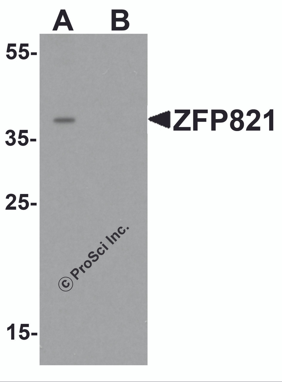 Western blot analysis of ZNF821 in Jurkat cell lysate with ZNF821 antibody at 0.5 &#956;g/ml in (A) the absence and (B) the presence of blocking peptide.