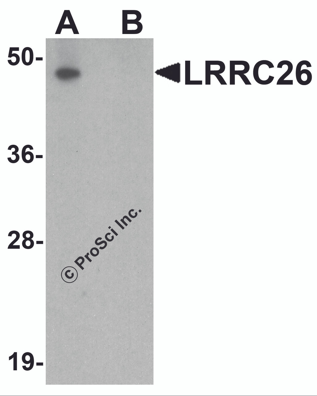 Western blot analysis of LRRC26 in human prostate tissue lysate with LRRC26 antibody at 0.5 &#956;g/ml in (A) the absence and (B) the presence of blocking peptide.