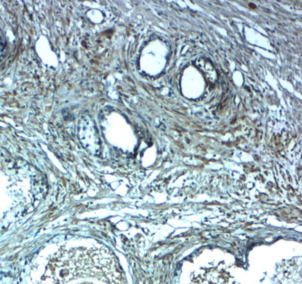 Immunohistochemistry of LRRC26 in human prostate tissue with LRRC26 antibody at 2.5 ug/mL.