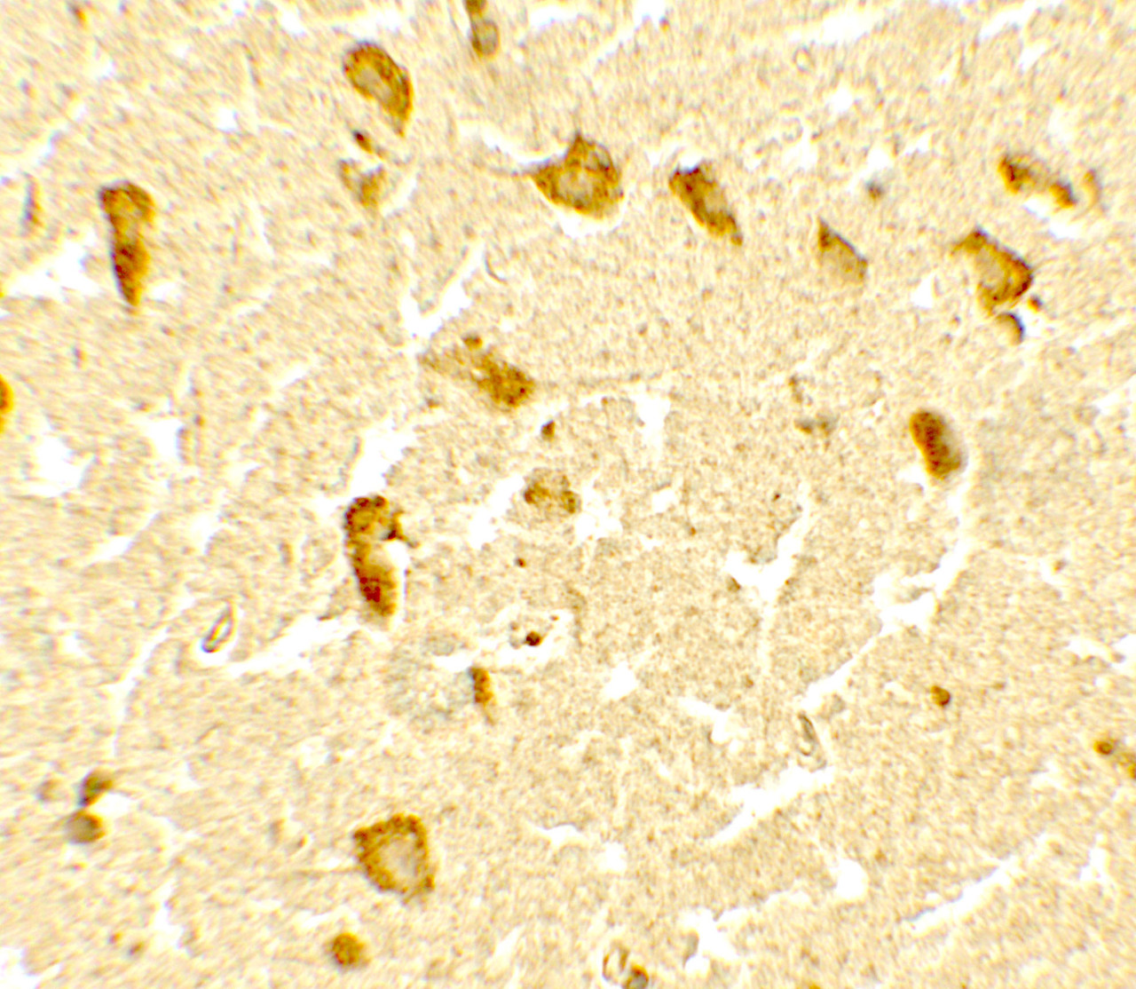 Immunohistochemistry of DPF3 in human brain tissue with DPF3 antibody at 5 ug/mL.