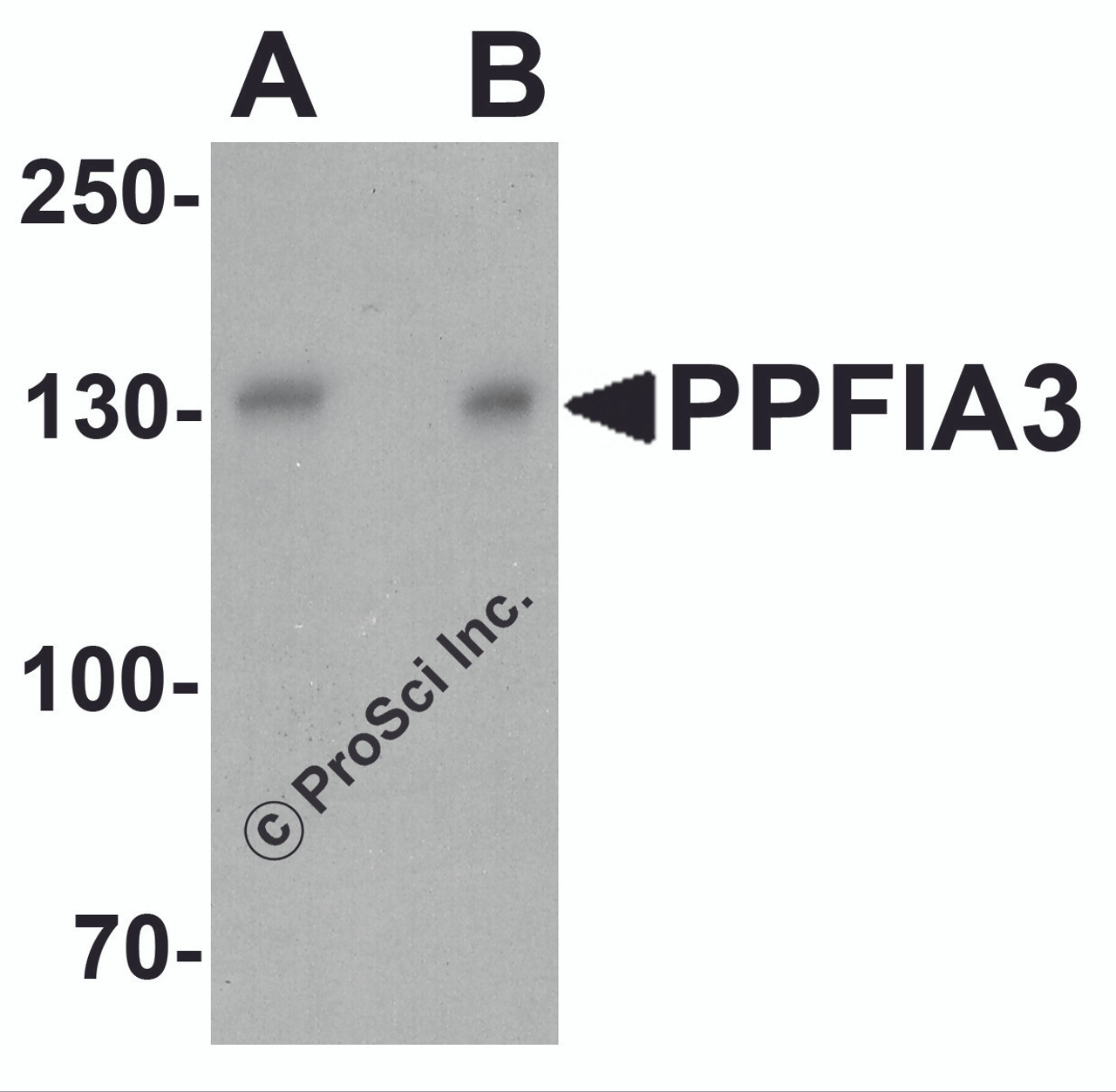 Western blot analysis of PPFIA3 in 293 cell lysate with PPFIA3 antibody at (A) 1 and (B) 2 &#956;g/ml.