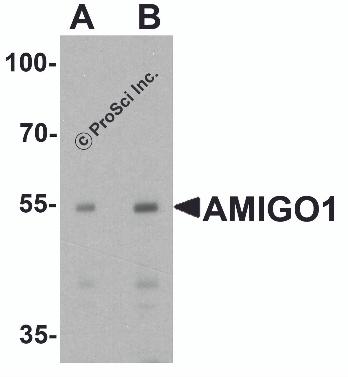 Western blot analysis of AMIGO1 in HeLa cell lysate with AMIGO1 antibody at (A) 1 and (B) 2 &#956;g/ml.