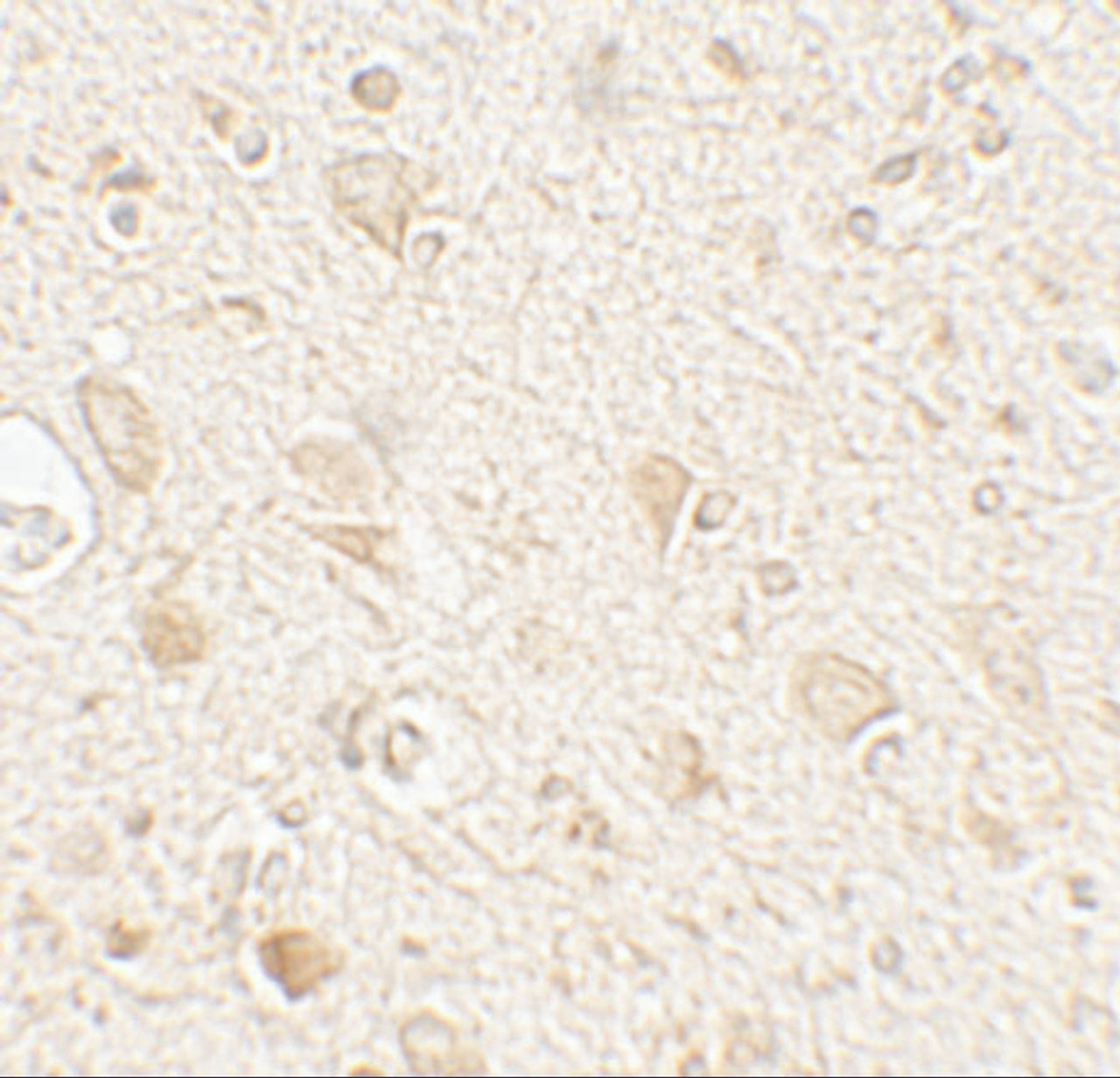 Immunohistochemistry of MAP1LC3A in human brain tissue with MAP1LC3A antibody at 5 ug/mL.