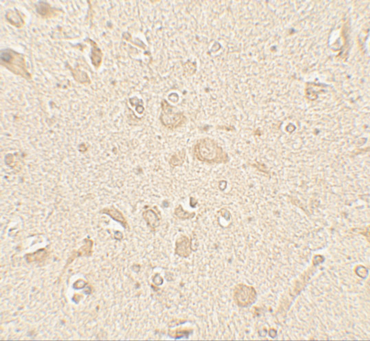 Immunohistochemistry of MAP1LC3B in human brain tissue with MAP1LC3B antibody at 5 ug/mL.
