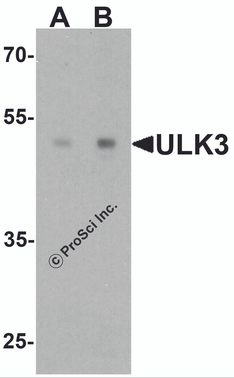 Western blot analysis of ULK3 in human brain tissue lysate with ULK3 antibody at (A) 0.5 and (B) 1 &#956;g/ml.