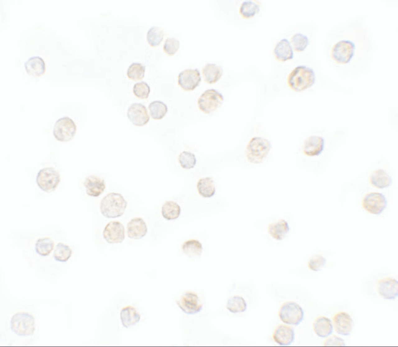 Immunocytochemistry of CXCL12 in HeLa cells with CXCL12 antibody at 5 ug/mL.