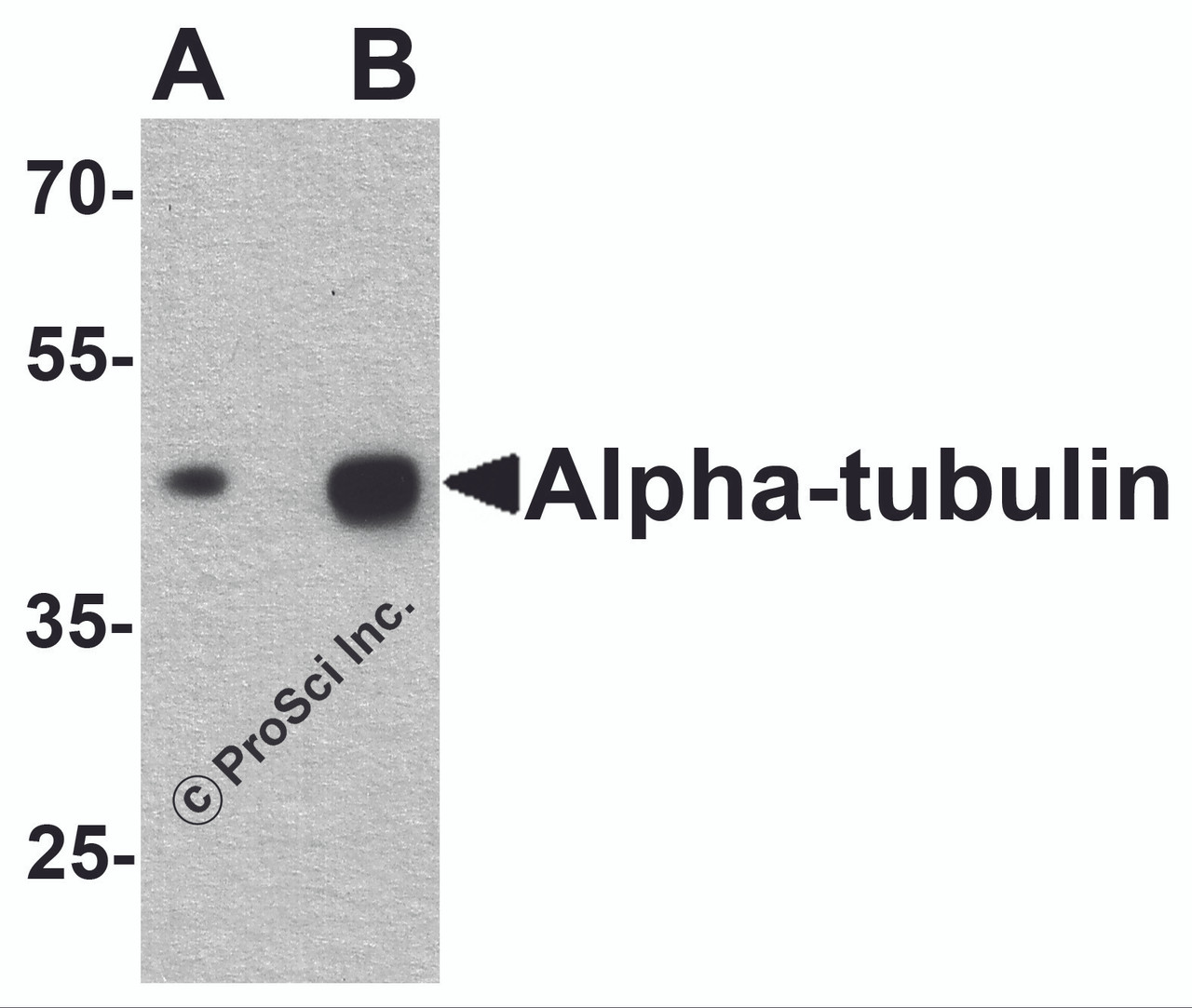Western blot analysis of alpha-tubulin in human brain tissue lysate with alpha-tubulin antibody at (A) 0.25 and (B) 0.5 &#956;g/ml.