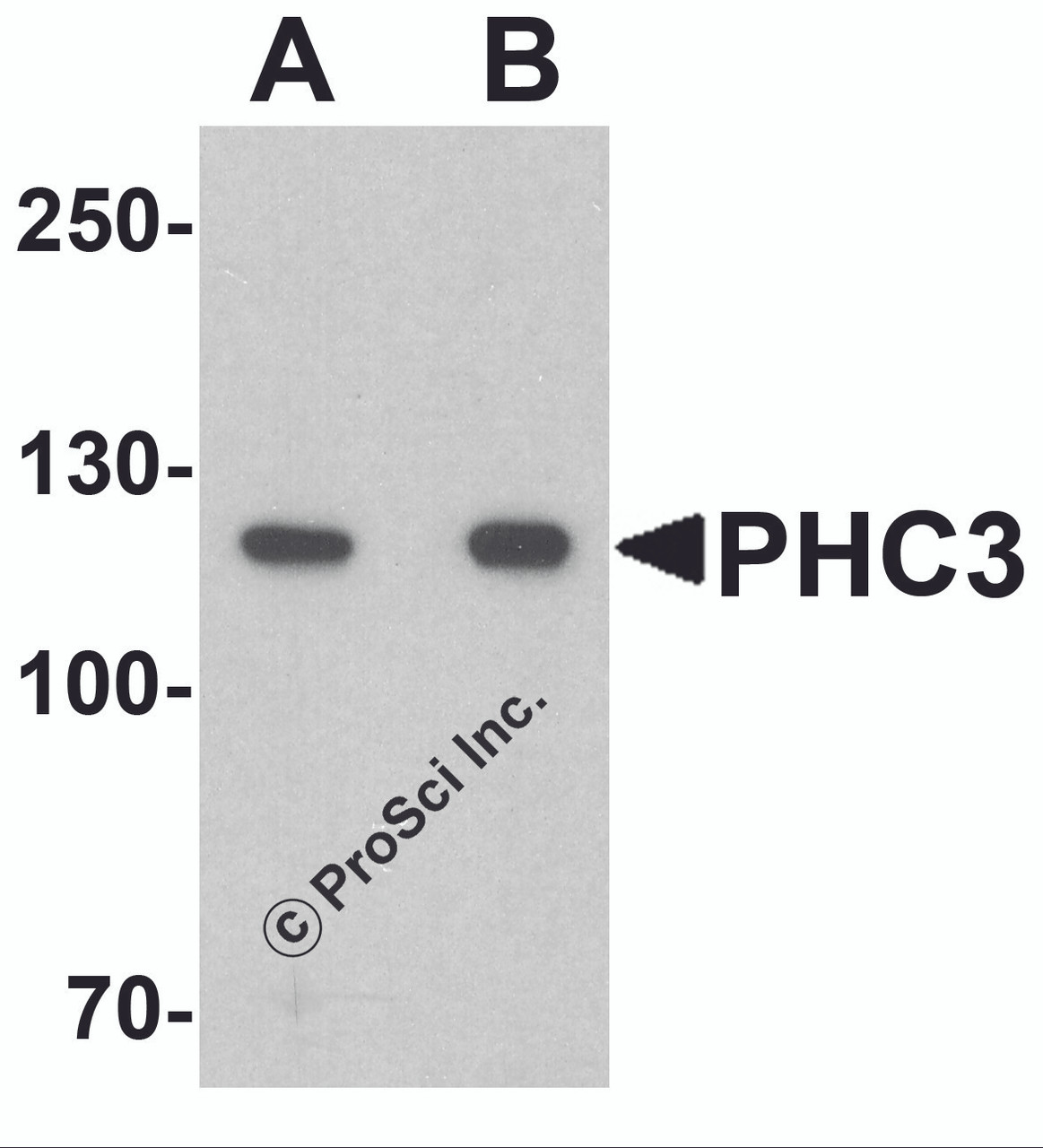 Western blot analysis of PHC3 in 3T3 cell lysate with PHC3 antibody at (A) 1 and (B) 2 &#956;g/ml.