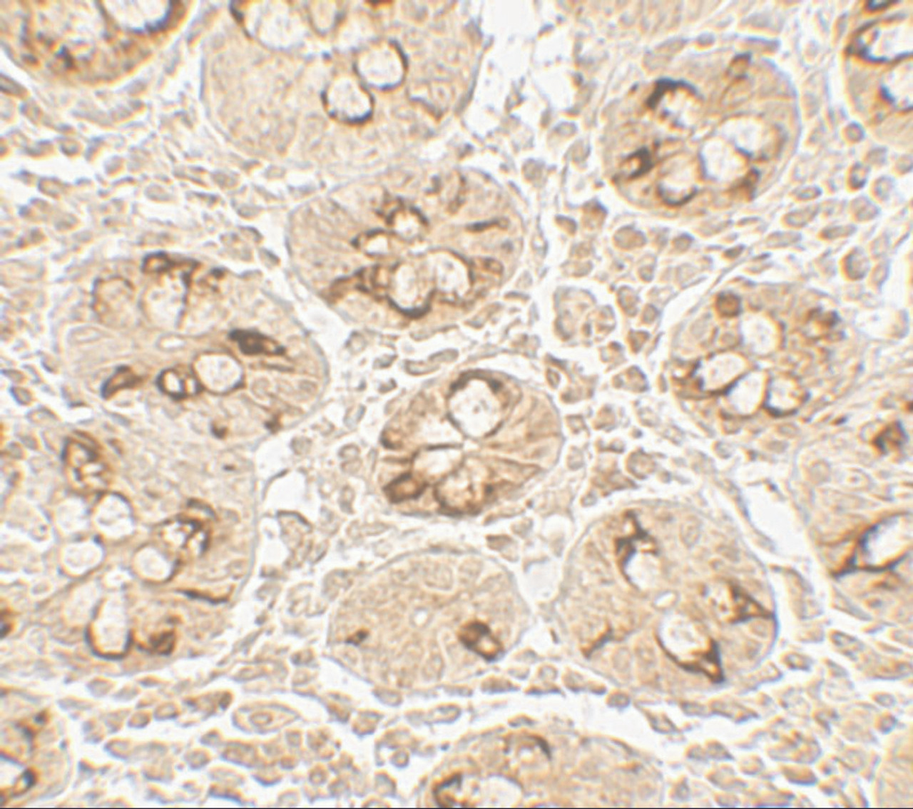 Immunohistochemistry of TMIGD2 in human small intestine tissue with TMIGD2 antibody at 5 ug/mL.
