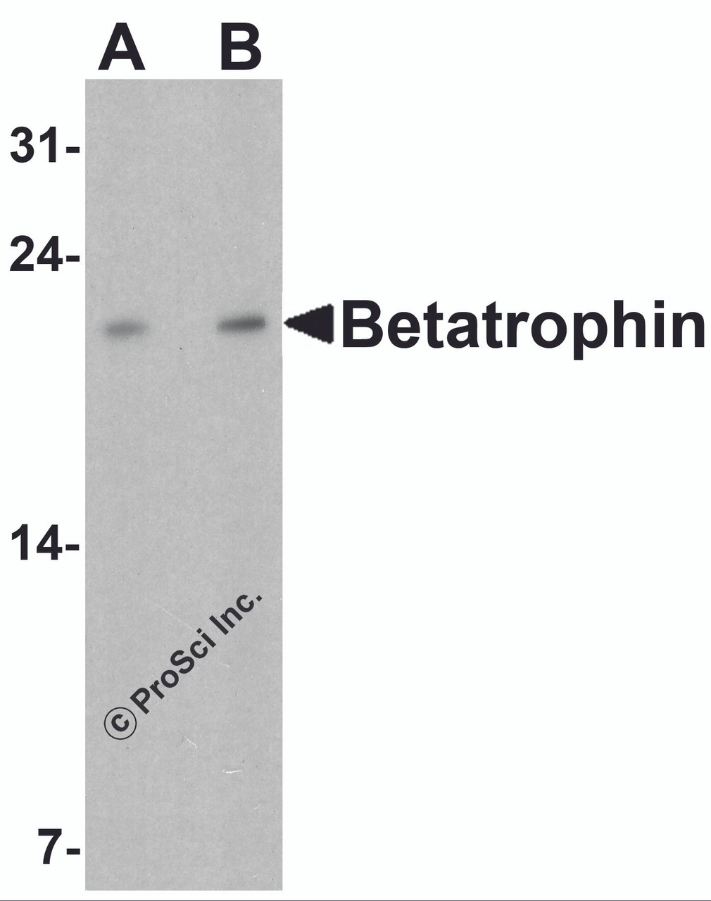 Western blot analysis of Betatrophin in rat liver tissue lysate with Betatrophin antibody at (A) 1 and (B) 2 &#956;g/ml.