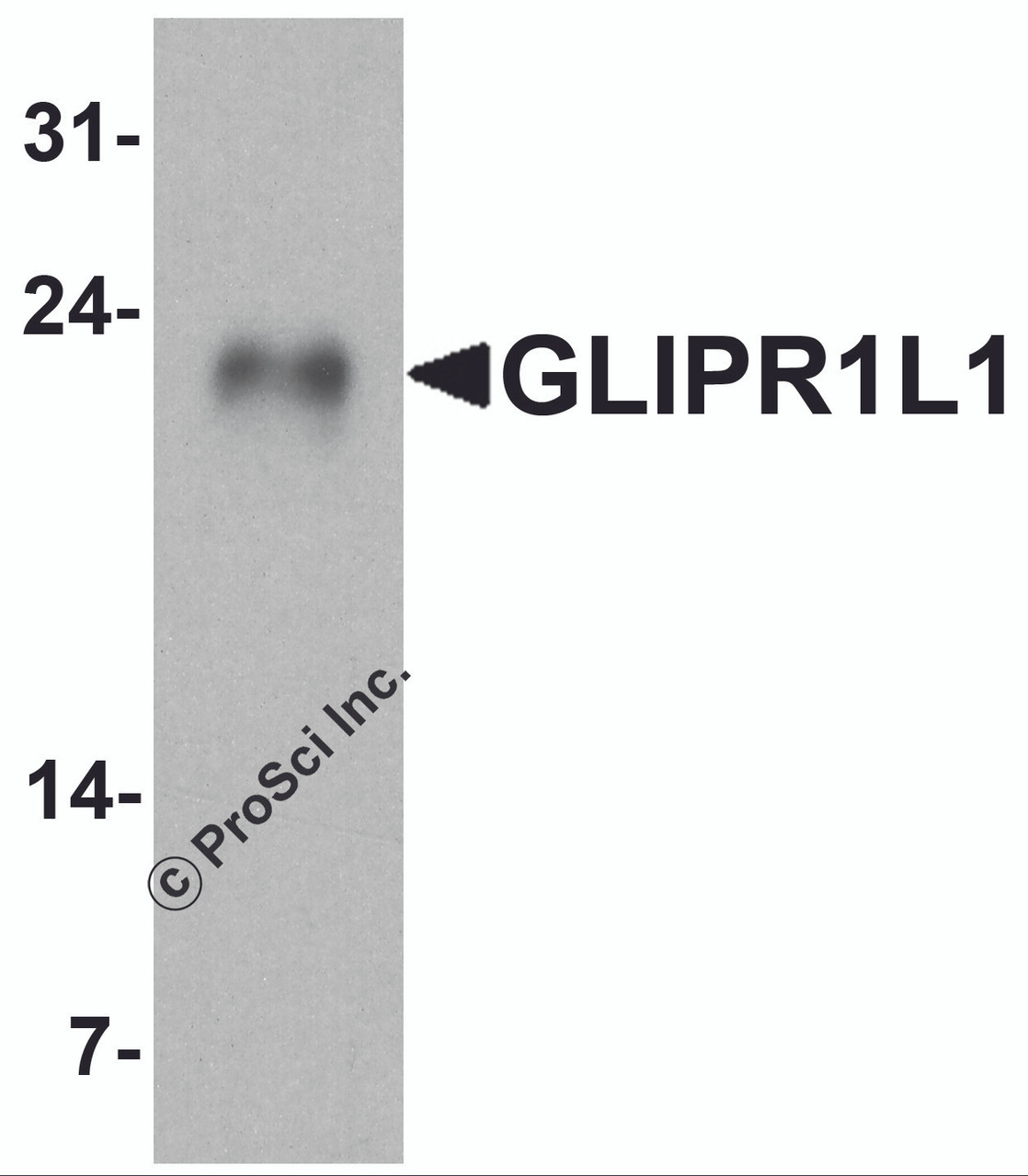 Western blot analysis of GLIPR1L1 in human testis tissue lysate with GLIPR1L1 antibody at 1 &#956;g/ml.