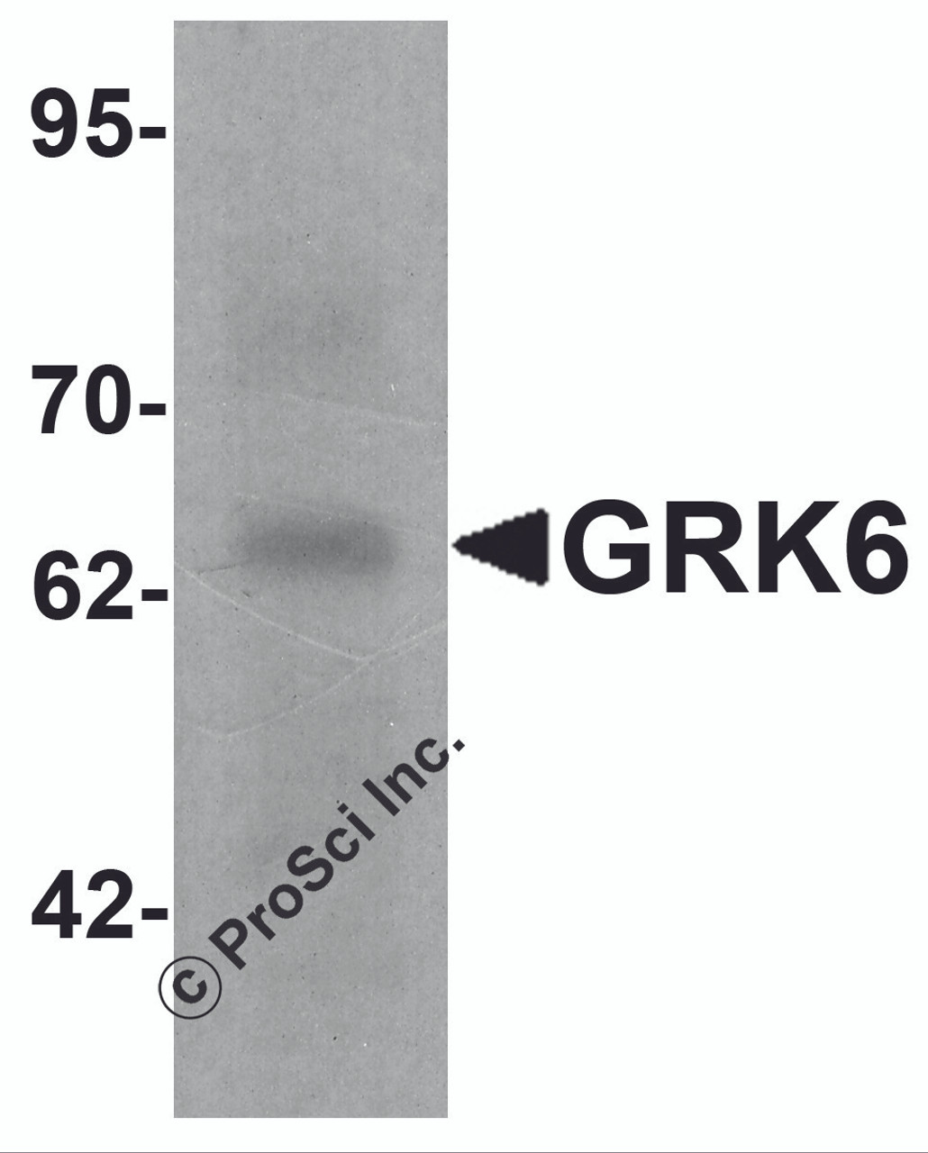 Western blot analysis of GRK6 in rat small intestine tissue lysate with GRK6 antibody at 1 &#956;g/ml.