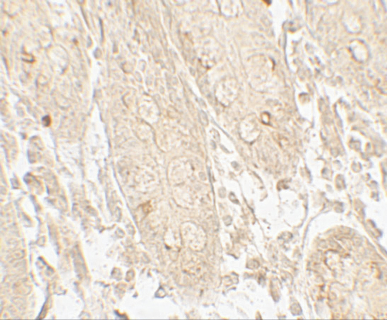 Immunohistochemistry of GRK6 in human small intestine tissue with GRK6 antibody at 5 ug/mL.