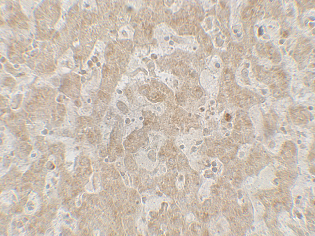 Immunohistochemistry of CCR7 in human spleen tissue with CCR7 antibody at 5 ug/mL.