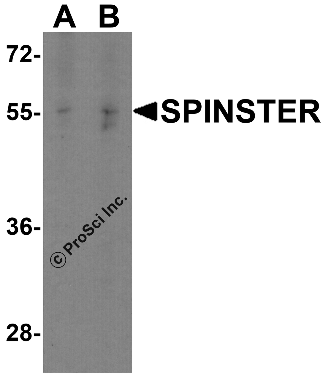 Western blot analysis of SPINSTER in HepG2 cell lysate with SPINSTER antibody at (A) 1 and (B) 2 &#956;g/ml.