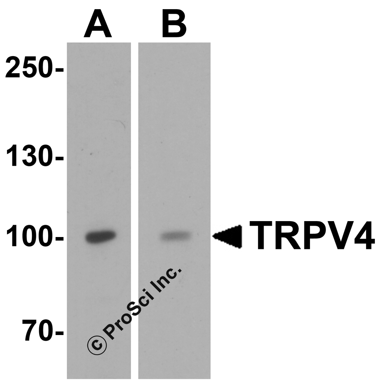 Western blot analysis of TRPV4 in (A) human testis tissue and (B) SK-N-SH cell lysate with TRPV4 antibody at 1 &#956;g/mL.