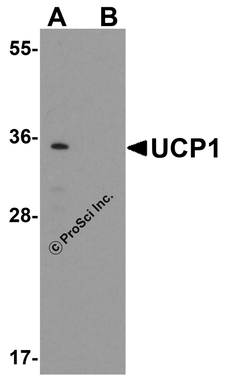 Western blot analysis of UCP1 in human brain tissue lysate with UCP1 antibody at 1 &#956;g/mL in (A) the absence and (B) the presence of blocking peptide.