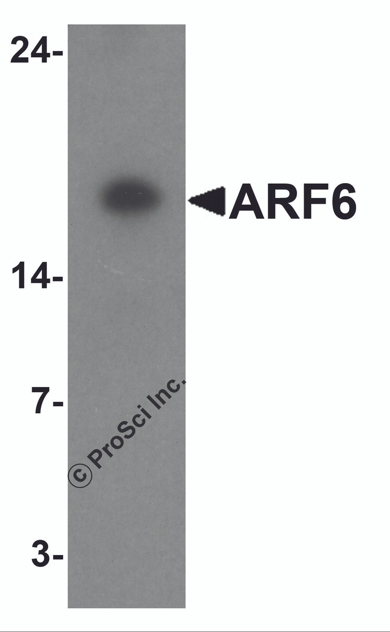 Western blot analysis of ARF6 in rat liver tissue lysate with ARF6 antibody at 1 &#956;g/ml.