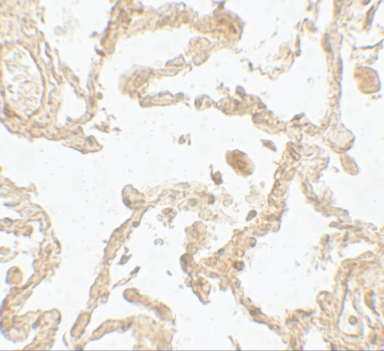 Immunohistochemistry of SUZ12 in human lung tissue with SUZ12 antibody at 5 ug/mL.