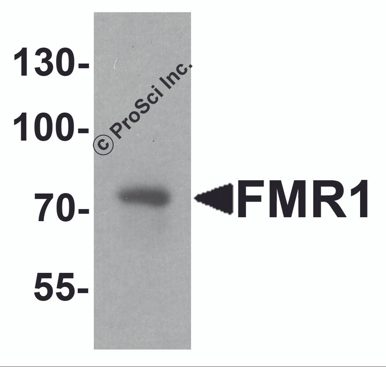 Western blot analysis of FMR1 in rat brain tissue lysate with FMR1 antibody at 1 &#956;g/ml.