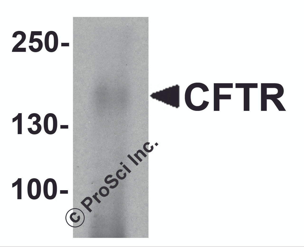 Western blot analysis of CFTR in human small intestine tissue lysate with CFTR antibody at 1 &#956;g/ml.