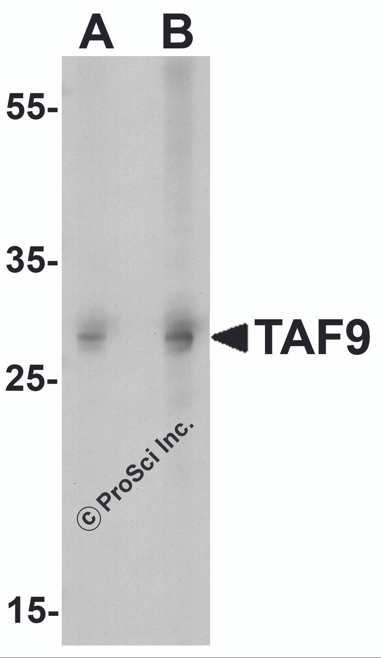 Western blot analysis of TAF9 in HepG2 cell lysate with TAF9 antibody at (A) 1 and (B) 2&#956;g/ml.