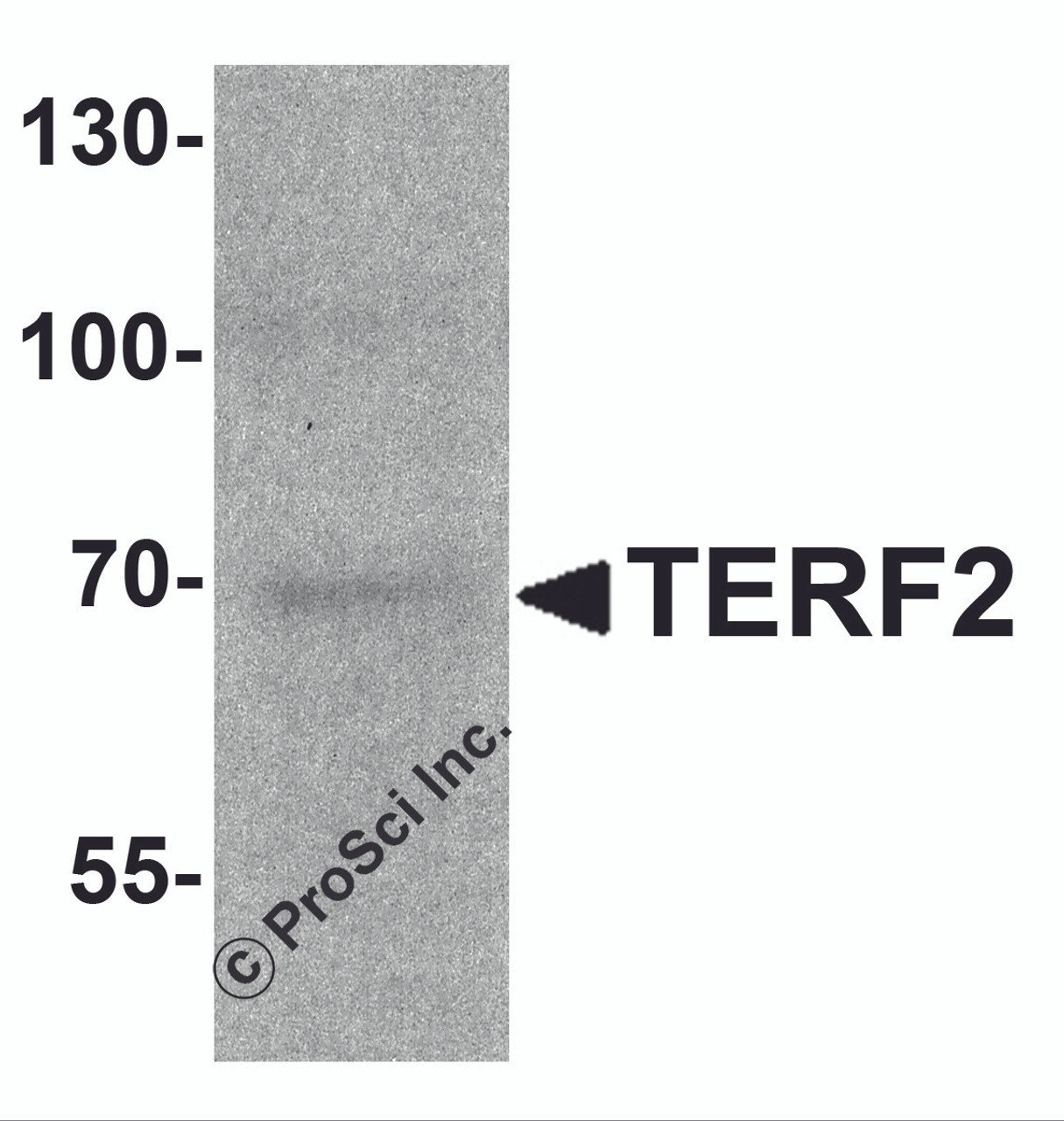 Western blot analysis of TERF2 in 293 cell lysate with TERF2 antibody at 1 &#956;g/ml.