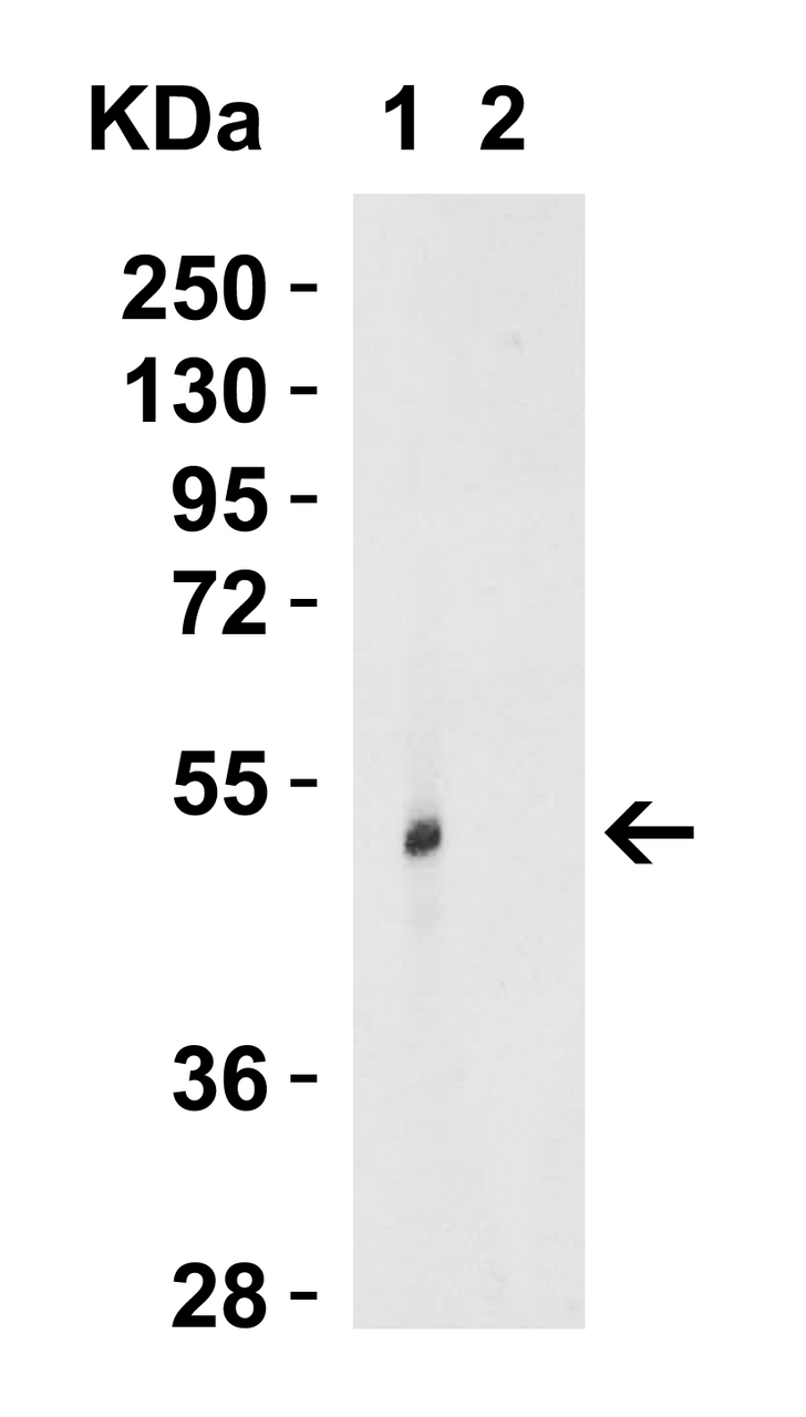 Figure 1 Western Blot Validation in Human Lung Tissue Lysate in (Lane 1) the absence and (Lane 2) the presence of blocking peptide
Loading: 15 &#956;g of lysates per lane.
Antibodies: TRIM21, 7729 (0.5 &#956;g/mL) , 1h incubation at RT in 5% NFDM/TBST.
Secondary: Goat anti-rabbit IgG HRP conjugate at 1:10000 dilution.