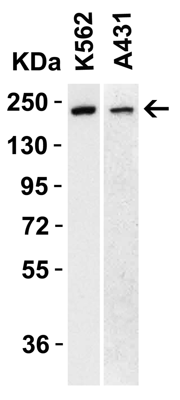 Figure 1 WB Validation of TET1 in Human Cell Lines 
Loading: 15 &#956;g of lysate 
Antibodies: TET1 7733, 1 &#956;g/mL, 1 h incubation at RT in 5% NFDM/TBST. 
Secondary: Goat Anti-Rabbit IgG HRP conjugate at 1:10000 dilution.