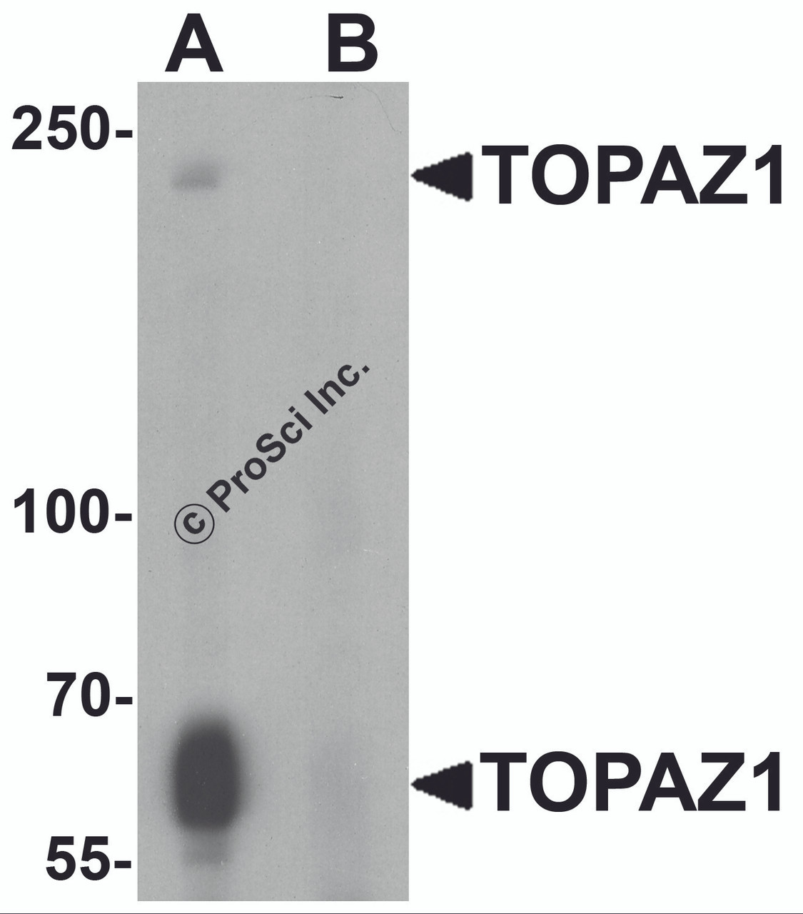 Western blot analysis of TOPAZ1 in human testis tissue lysate with TOPAZ1 antibody at 1 &#956;g/ml in (A) the absence and (B) the presence of blocking peptide.
