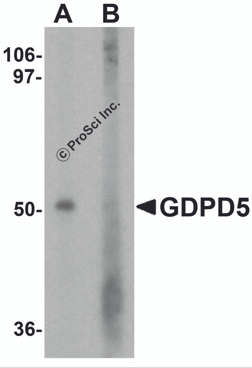 Western blot analysis of GDPD5 in mouse kidney tissue lysate with GDPD5 antibody at 1 &#956;g/ml in (A) the absence and (B) the presence of blocking peptide.