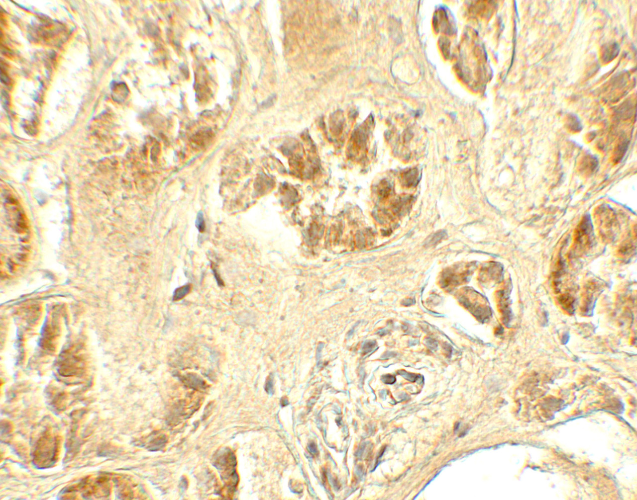 Immunohistochemistry of GDPD5 in human kidney tissue with GDPD5 antibody at 5 ug/mL.
