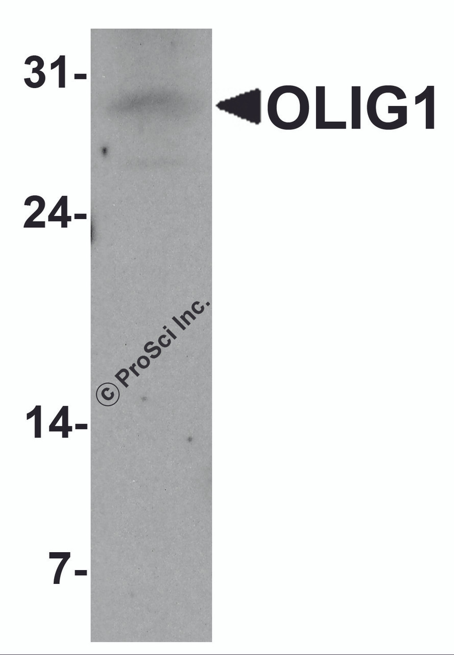 Western blot analysis of OLIG1 in A549 cell lysate with OLIG1 antibody at 1 &#956;g/ml.