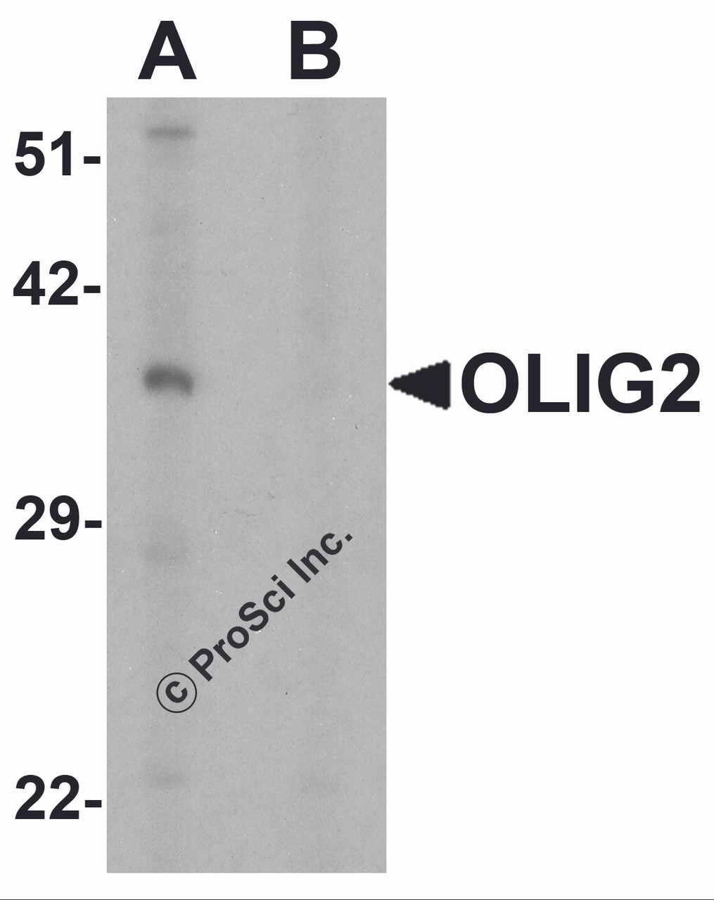 Western blot analysis of OLIG2 in EL4 cell lysate with OLIG2 antibody at 1 &#956;g/ml in (A) the absence and (B) the presence of blocking peptide.