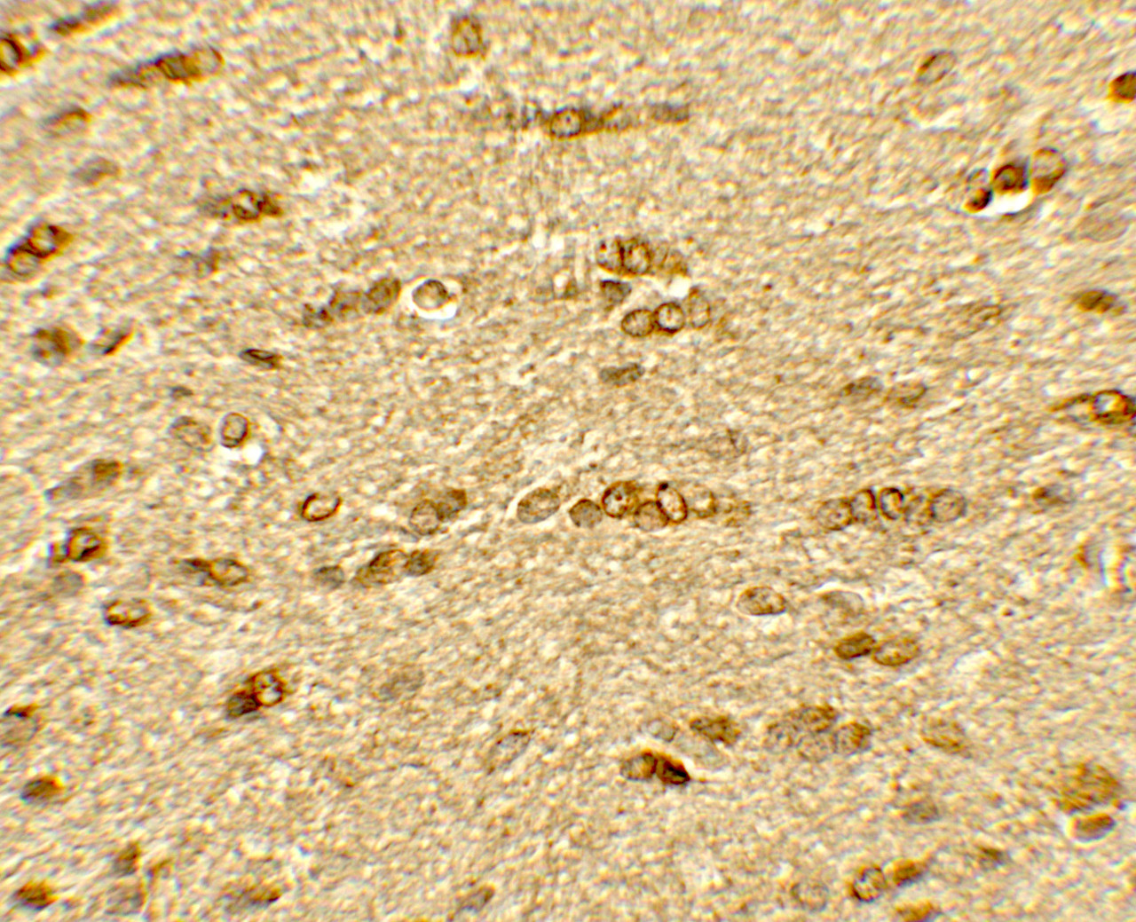 Immunohistochemistry of OLIG2 in rat brain tissue with OLIG2 antibody at 5 ug/mL.