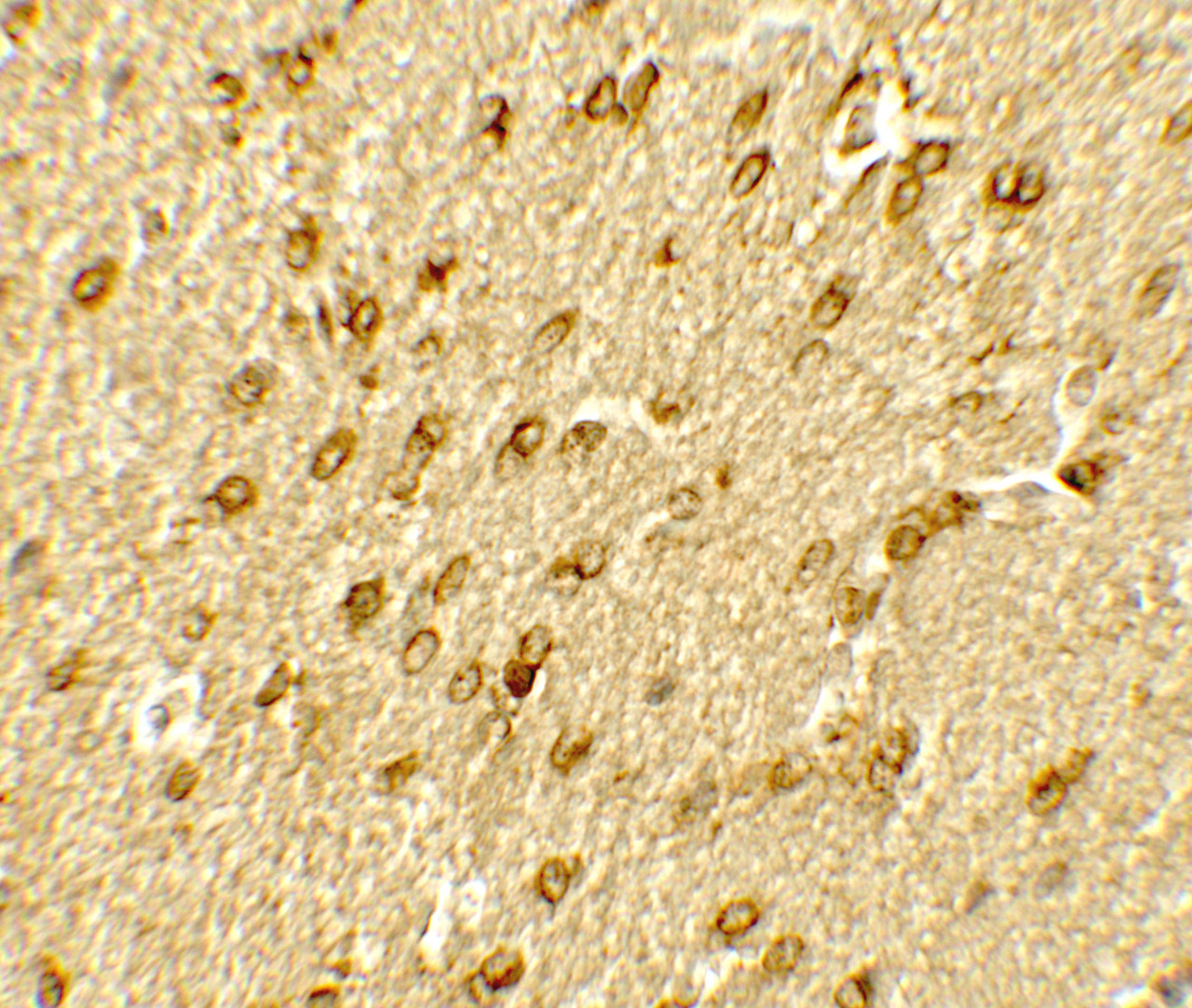 Immunohistochemistry of SMARCA4 in rat brain tissue with SMARCA4 antibody at 5 ug/mL.