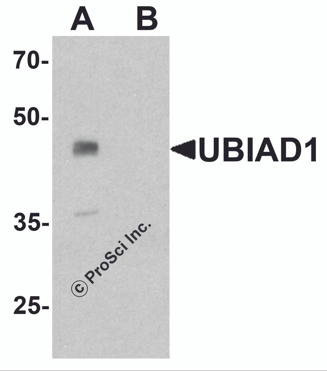 Western blot analysis of UBIAD1 in mouse liver tissue lysate with UBIAD1 antibody at 1 &#956;g/ml in (A) the absence and (B) the presence of blocking peptide.