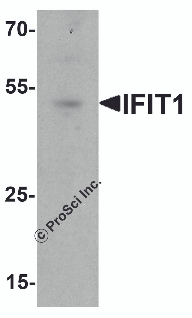 Western blot analysis of IFIT1 in rat small intestine tissue lysate with IFIT1 antibody at 1 &#956;g/ml.