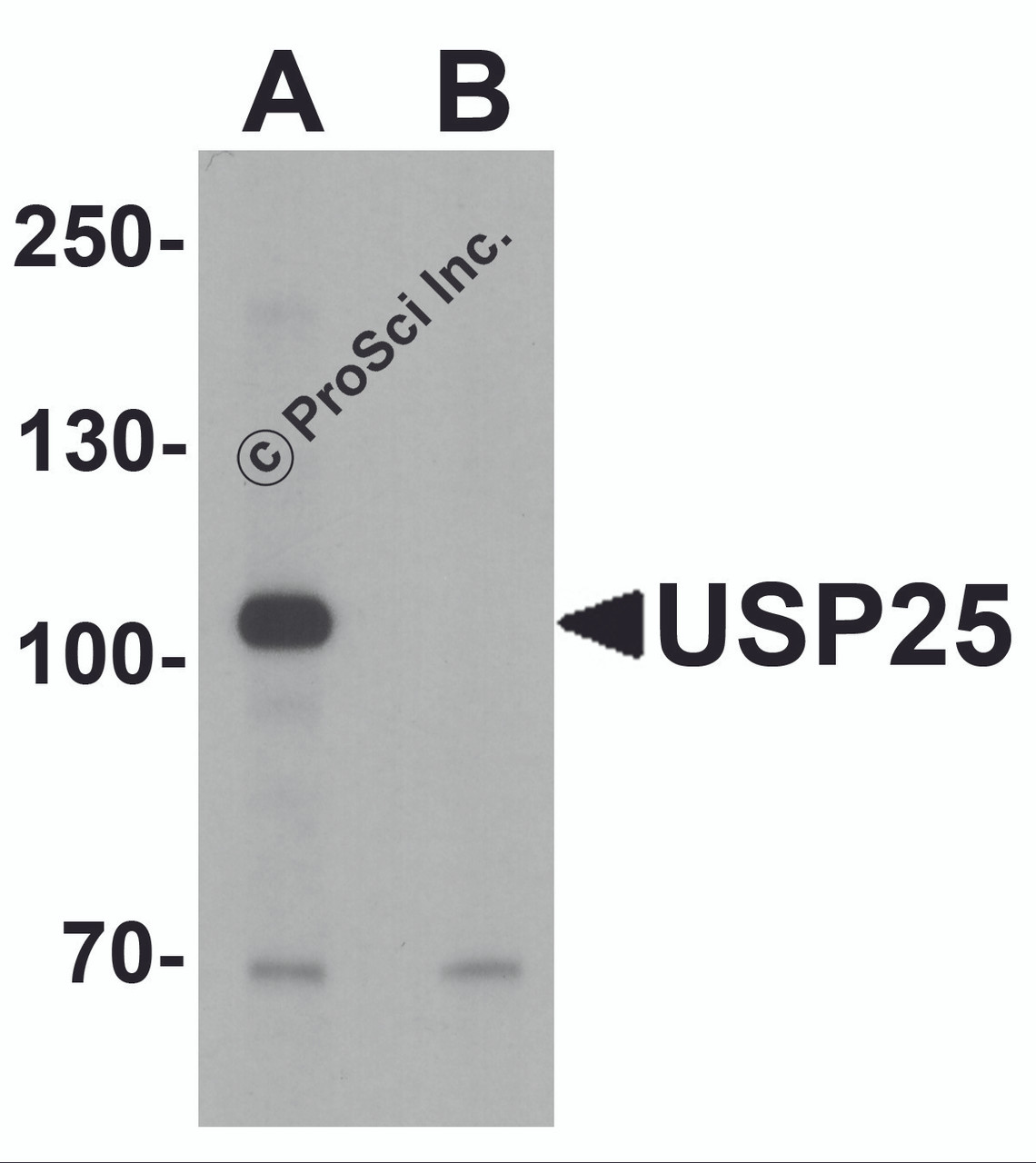 Western blot analysis of USP25 in mouse brain tissue lysate with USP25 antibody at 1 &#956;g/ml in (A) the absence and (B) the presence of blocking peptide.
