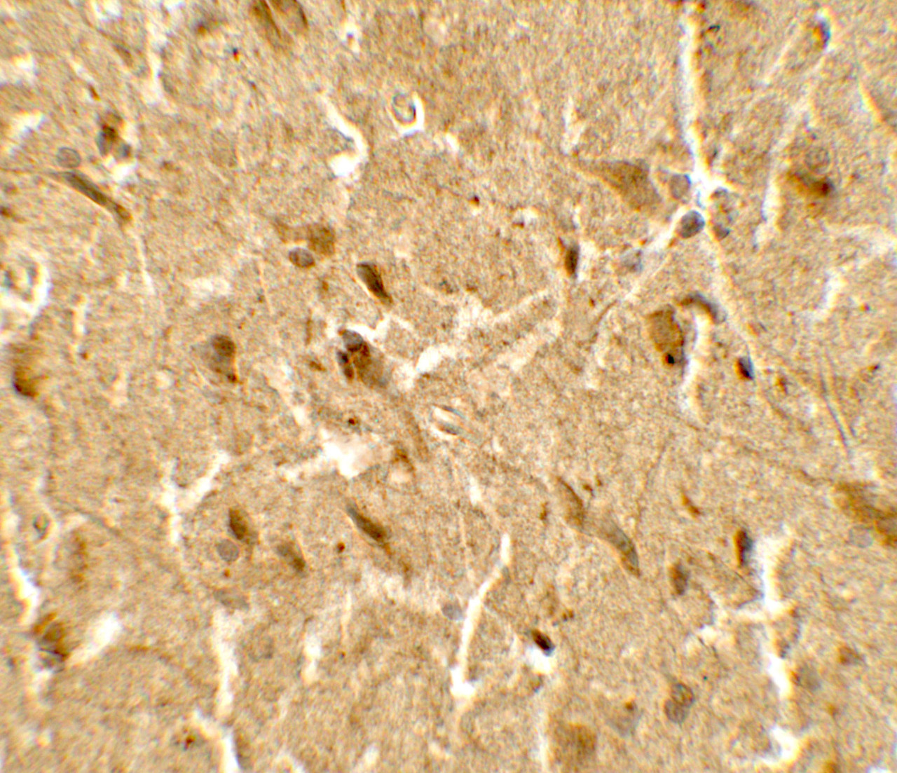 Immunohistochemistry of USP25 in human brain tissue with USP25 antibody at 5 ug/mL.