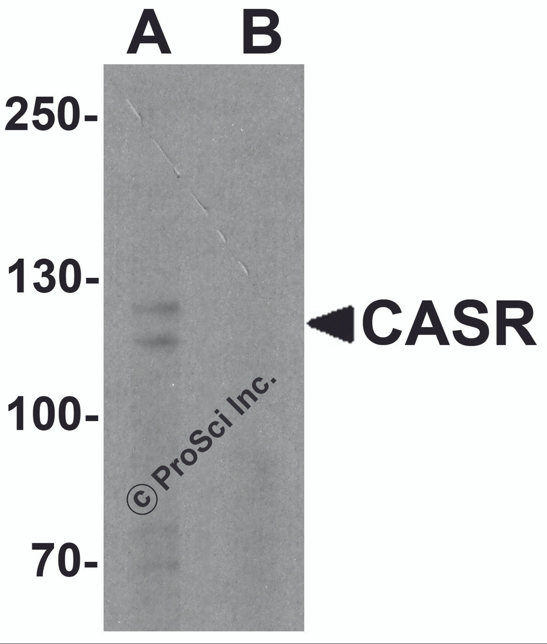Western blot analysis of CASR in EL4 cell lysate with CASR antibody at 1 &#956;g/ml in (A) the absence and (B) the presence of blocking peptide.